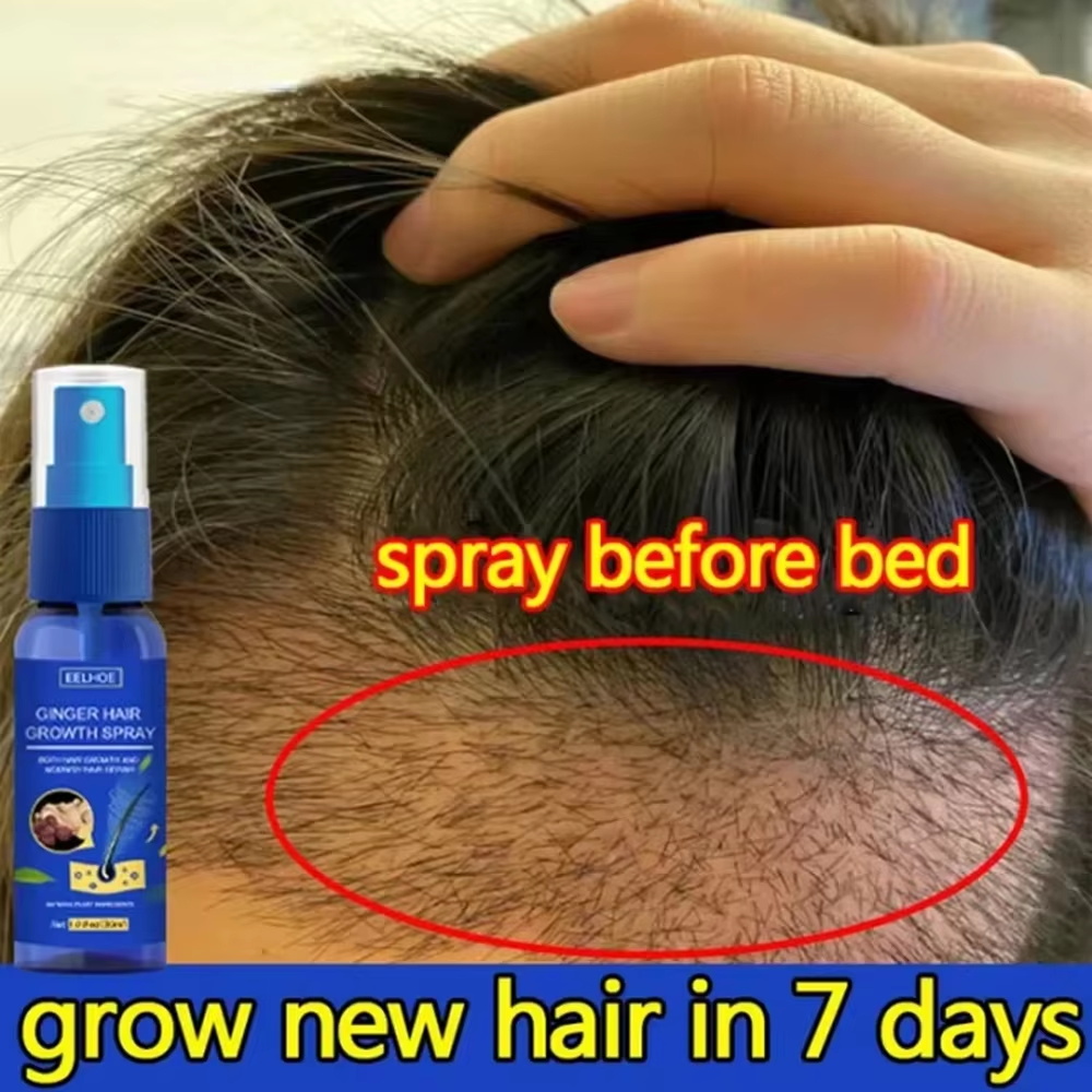 Hair Care Natural - สเปรย์เร่งผมยาวขึ้นอย่างรวดเร็ว บำรุงรากผม ป้องกันผมร่วง เซรั่มปลูกผมใหม่ ซ่อมแซมหนังศีรษะที่เสียหาย บำรุงและดูแลเส้นผม