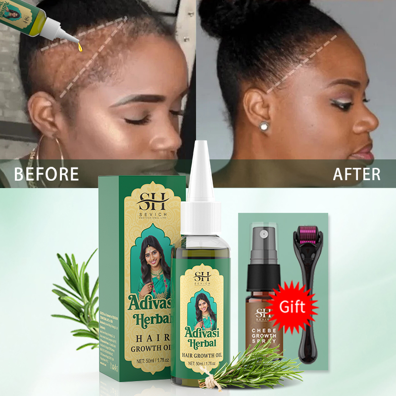 น้ำมันบำรุงผมอายุรเวทจากอินเดี - Hair Care Essence Oil บทวิจารณ์และราคา