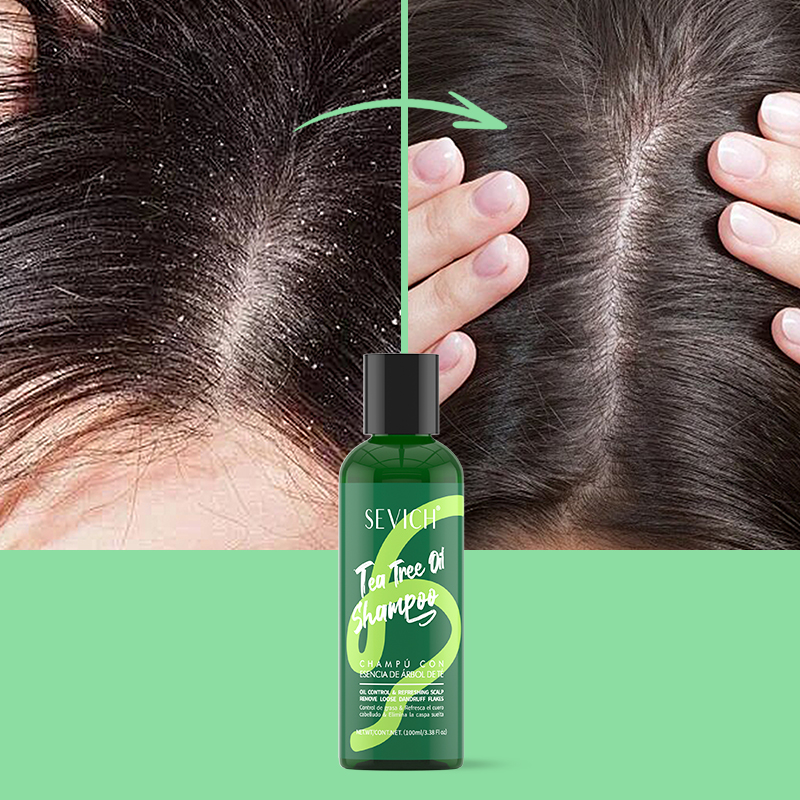 Tea Tree Essence แชมพูครีมนวดผ - Hair Care Set บทวิจารณ์และราคา