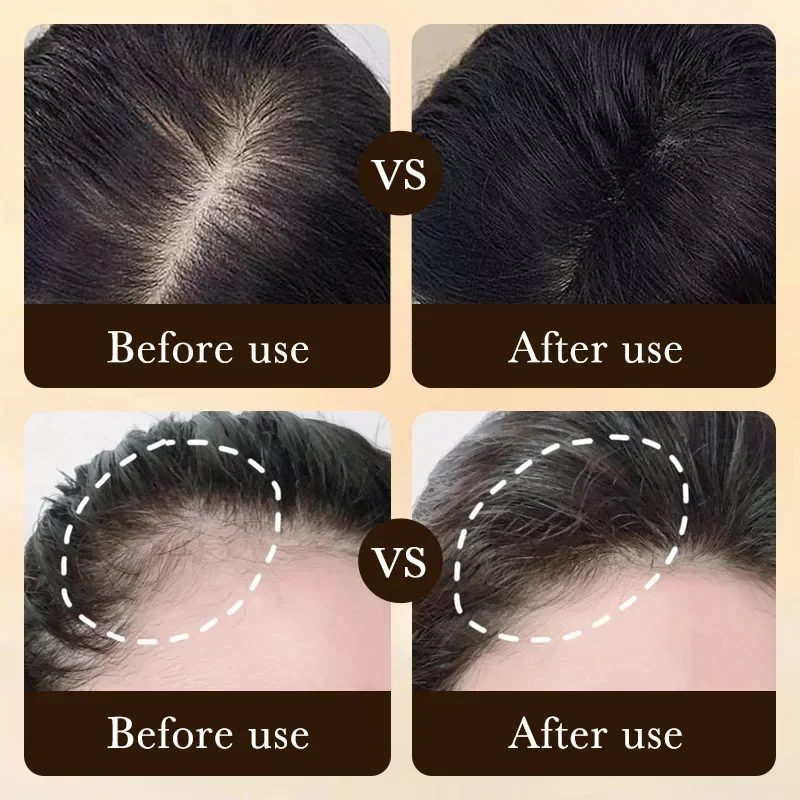 ผลิตภัณฑ์น้ำมันบำรุงผมไบโอติน  - Hair Care Essence Oil บทวิจารณ์และราคา