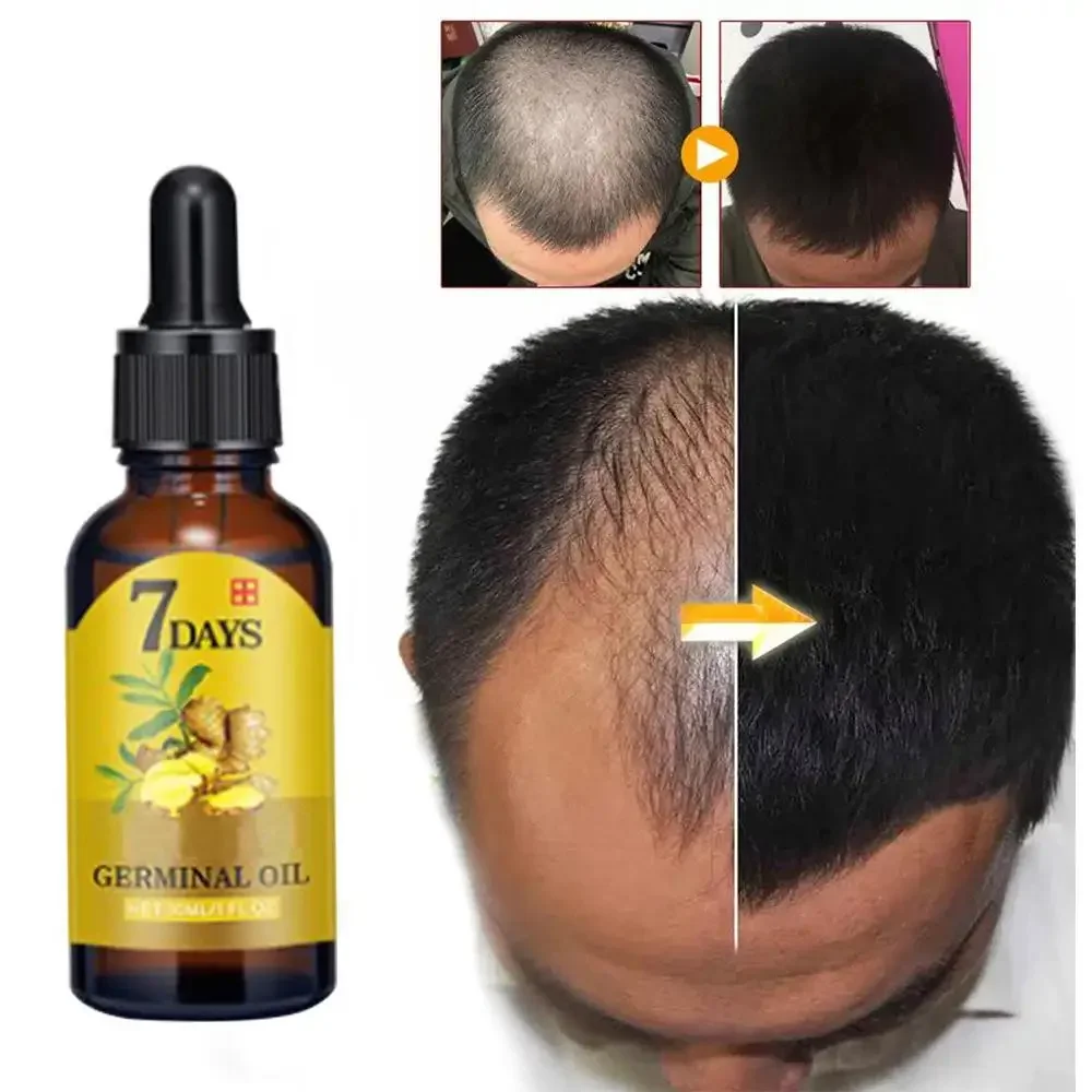 Hair Growth Ginger Fast Growin - Hair Care Essence Oil บทวิจารณ์และราคา